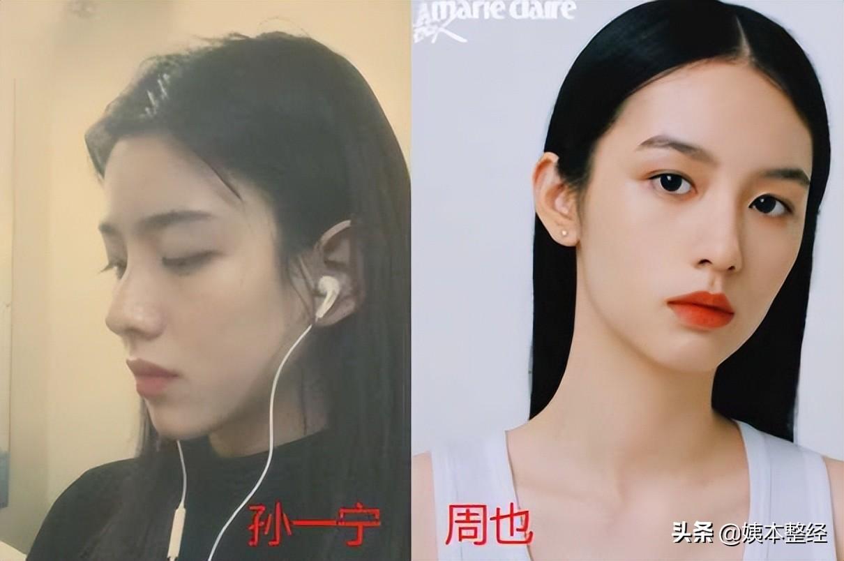 你们觉得孙一宁的长相有做过整形吗？-孙一宁百度百科