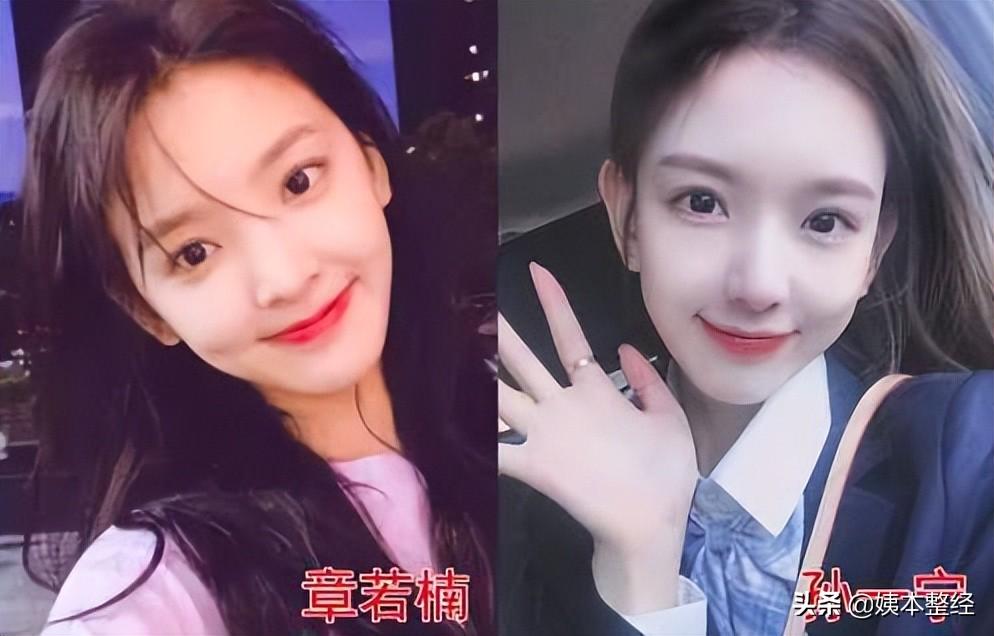 你们觉得孙一宁的长相有做过整形吗？-孙一宁百度百科