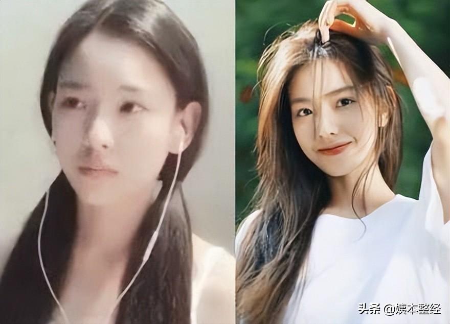 你们觉得孙一宁的长相有做过整形吗？-孙一宁百度百科